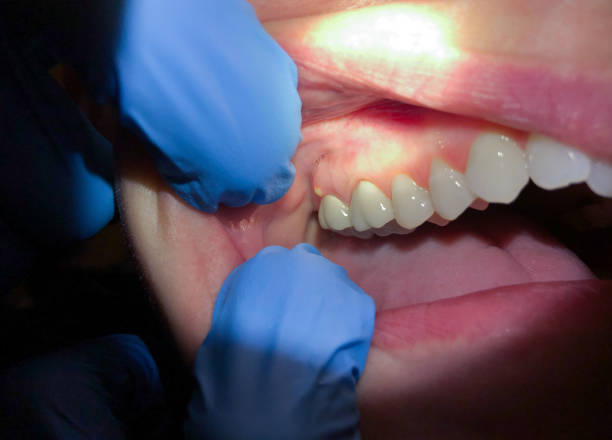 Best Walk-In Dentist Near Me  in Elmwood, LA