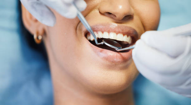 Best Emergency Gum Pain Relief  in Elmwood, LA